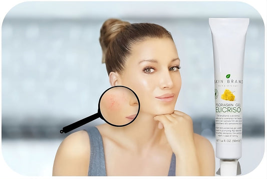 La Dermatite Atopica e I Suoi Rimedi Naturali